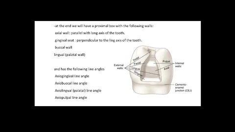 Operative L4 (Class II cavity preparation)