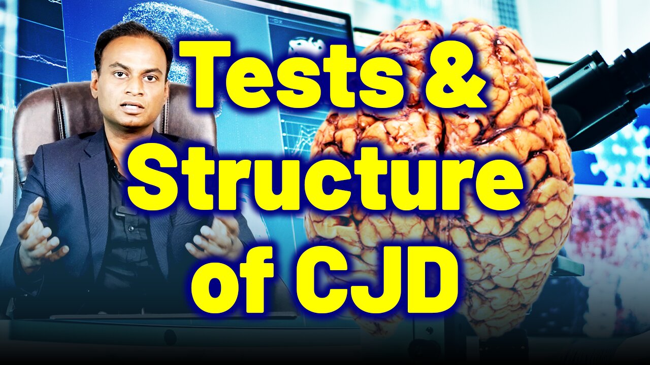 Test and Structure and Function of Brain in CJD Remedy Solution .