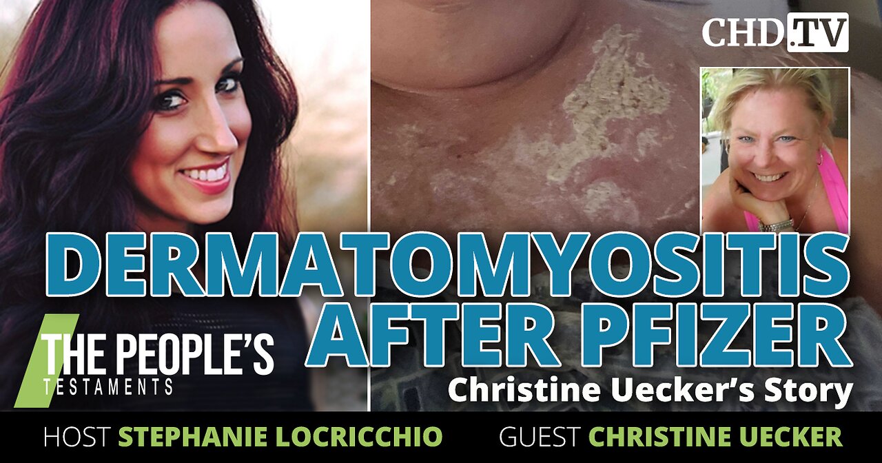 ‘Dermatomyositis After Pfizer: Christine Euecker’s Story’