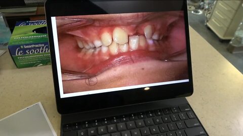 Colorado Medicaid corrects code change issue that impacted dental care for low-income children