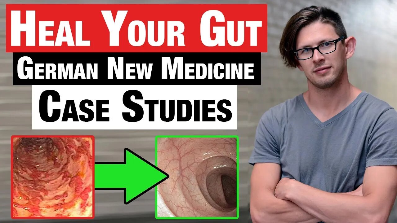 How To Heal Your Gut With German New Medicine || Step by Step Guide Treatment Plan