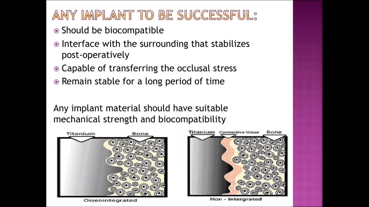 Prosthodontics L6 (Materials of Dental Implant)