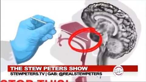 V863. 🚨WARNING🚨SWABS🚨☠