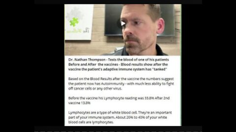 Dr Nathan Thompson test the blood of his Vaxxed patient!!