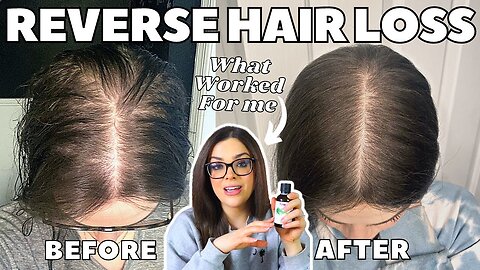 How I STOPPED MY HAIR LOSS! | #1 Thing That Re-Grew My Hair