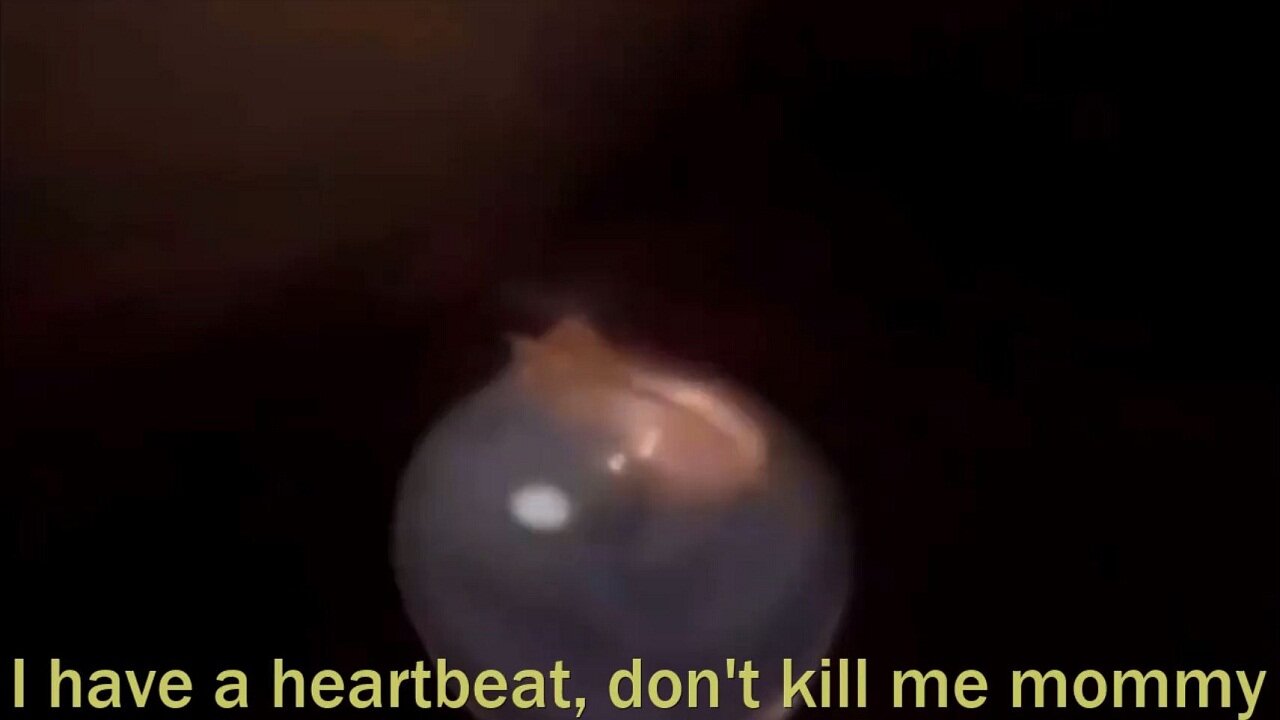 I have a heartbeat don't kill me mommy