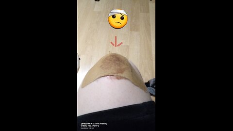 I skin my knee on concrete.