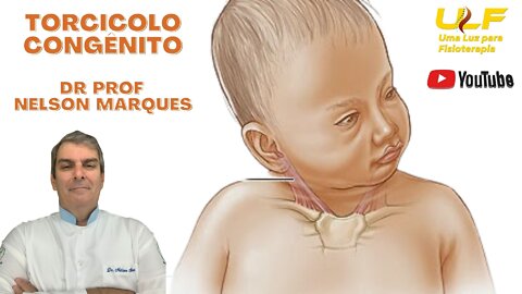 Torcicolo Congênito - Dr. Prof. Nelson Marques