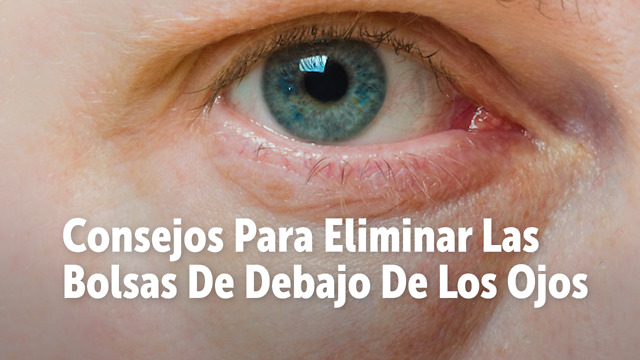 Consejos Para Eliminar Las Bolsas De Debajo De Los Ojos