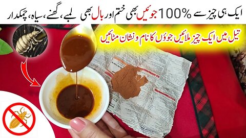 جوئیں ختم کرنے کے طریقے | john ko khatam karne ka tarika | juon or likhon ka khatma