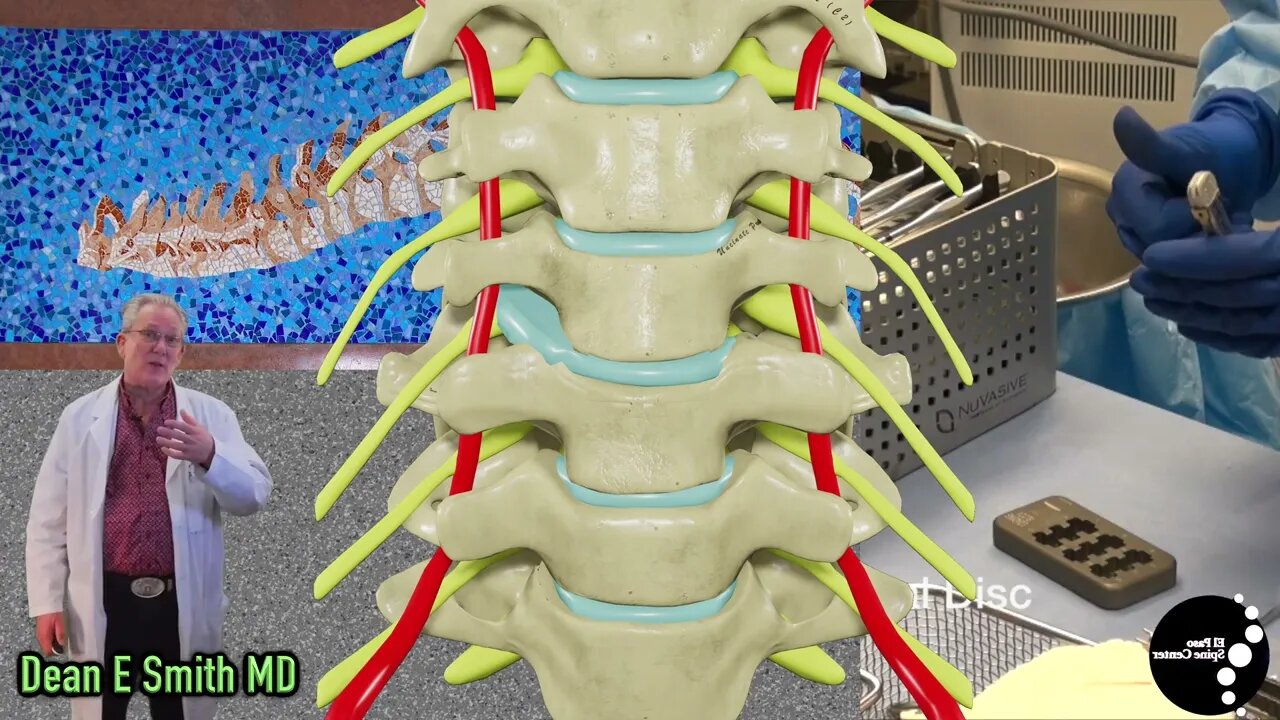 Artificial Cervical Disc