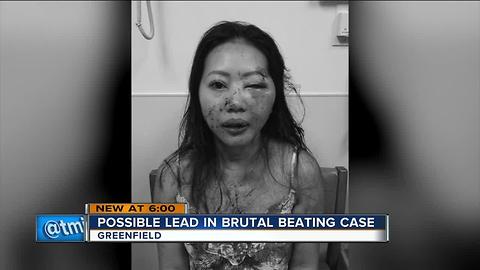 Possible lead in brutal beating case