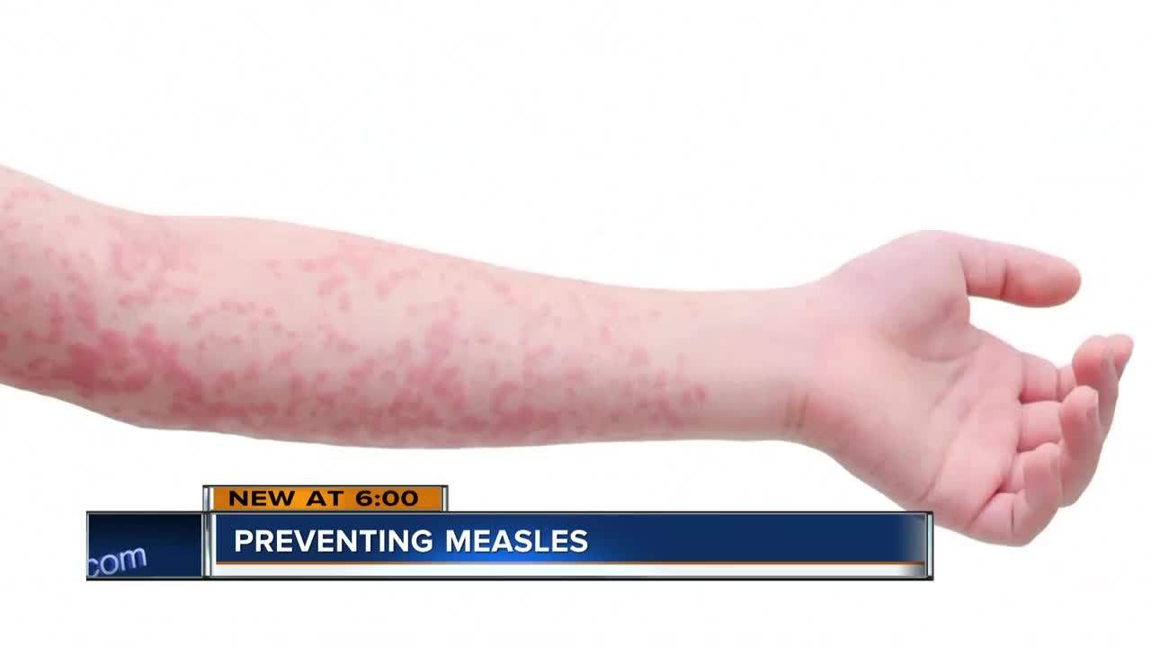 "It's only a matter of time." Measles outbreak spreading