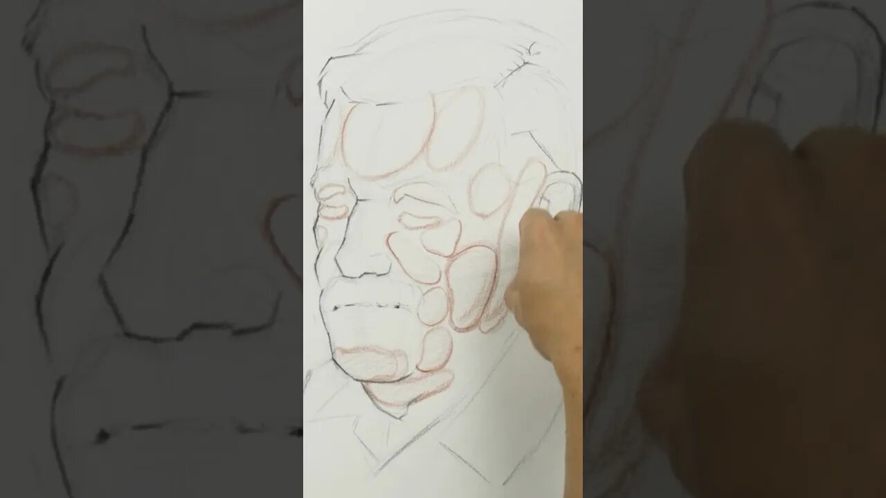 Fat Pads Of The Face Lesson Excerpt.