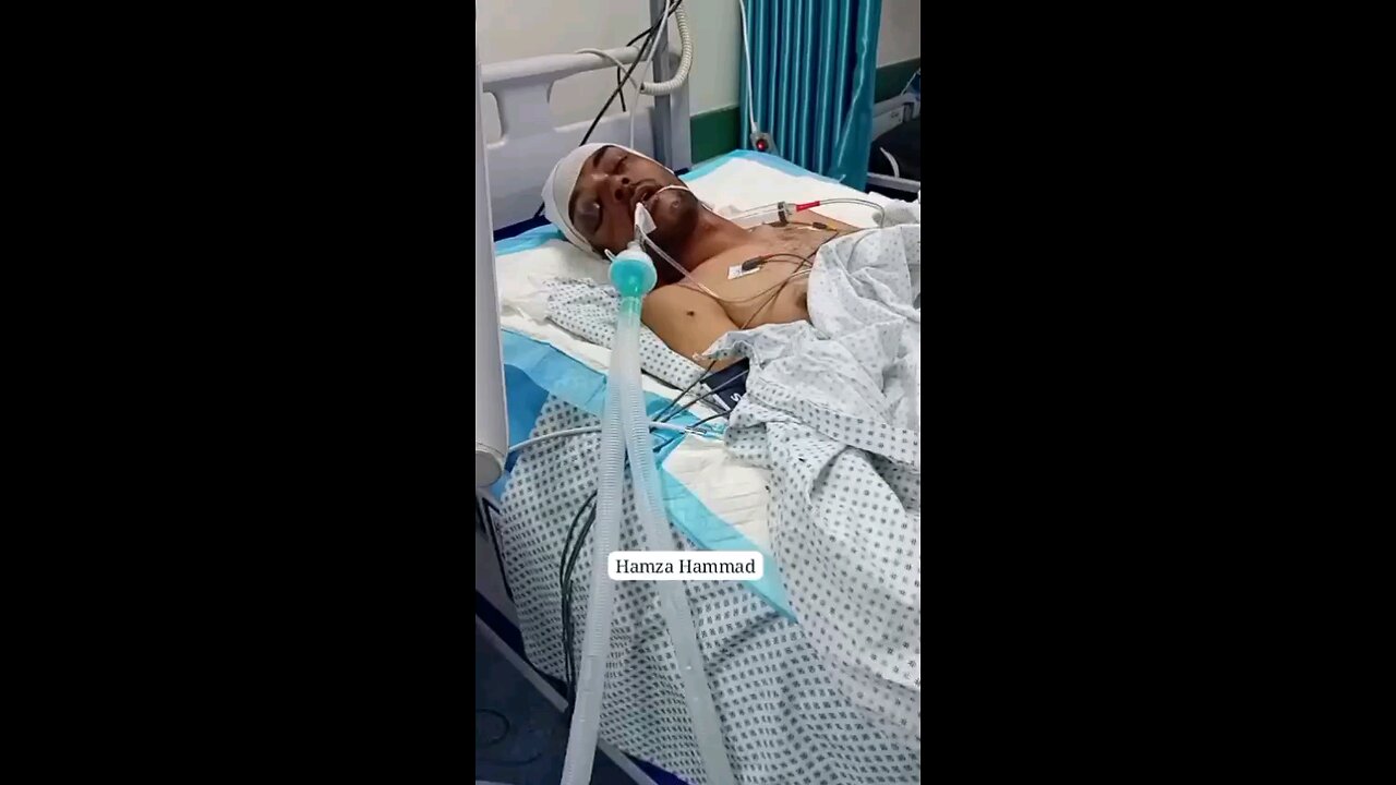 الصحفي مسؤل التحرير محمد في العناية المركزة بعد إصابته بجروح خطيرة جراء قصف "إسرائيلي" غرب غزة