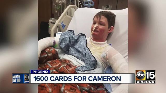 Tucson boy who suffered second-degree burns asking for birthday cards