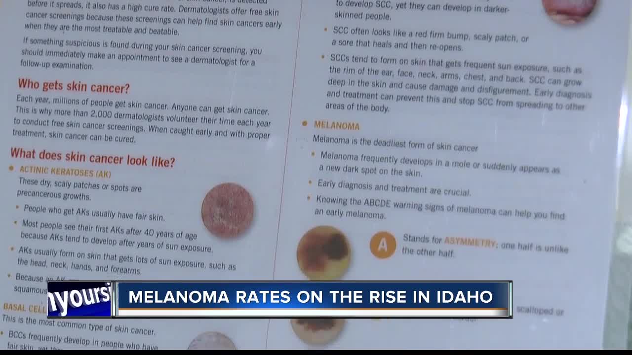Melanoma rates on the rise in Idaho