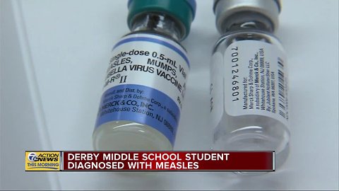 Birmingham student diagnosed with measles