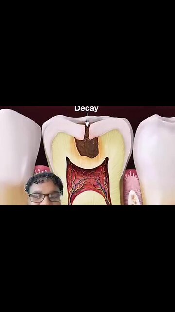 IT'S TIME TO REVERSE YOU TOOTH DECAY NATURALLY! LISTEN TO THIS! ☤ DR KEK