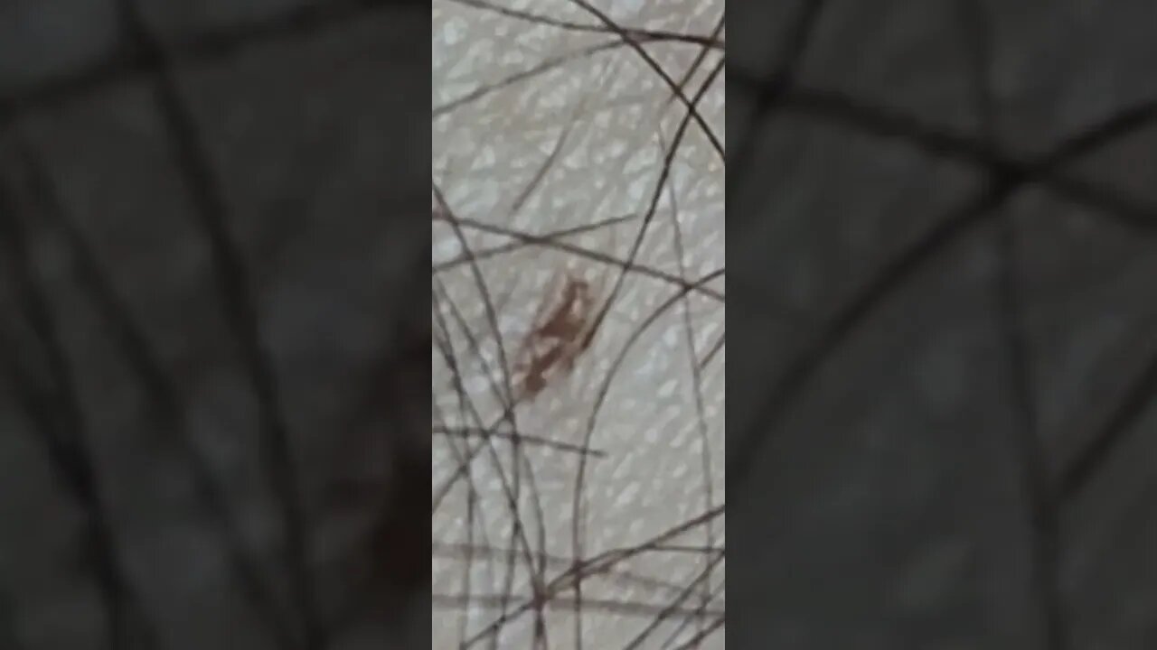 Zooming-in on my skin/leg just to find a spot