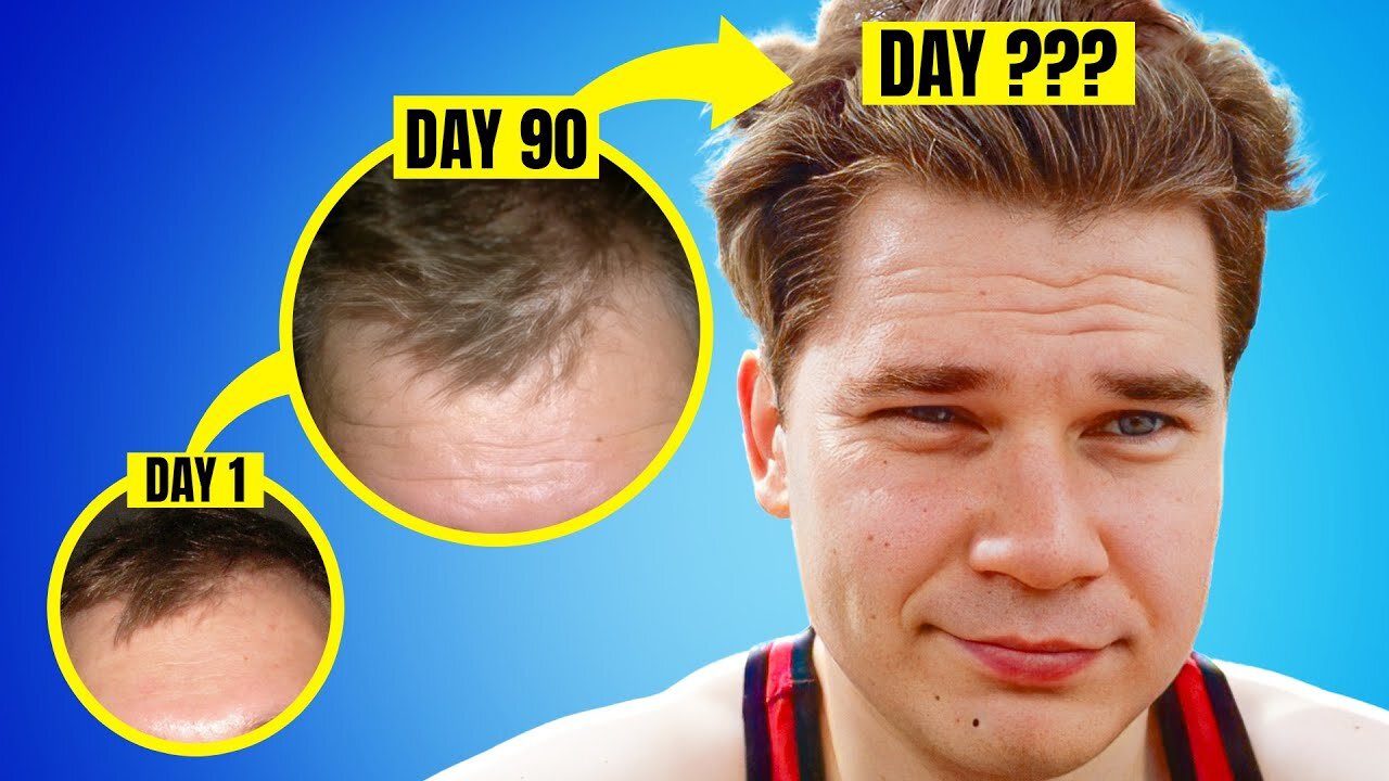 How Long Does It Take To See That Finasteride Really Work?