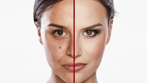 Dark circles? Moles? Blemishes? Take care of all with Subliminals In Less Than 10 Minutes!
