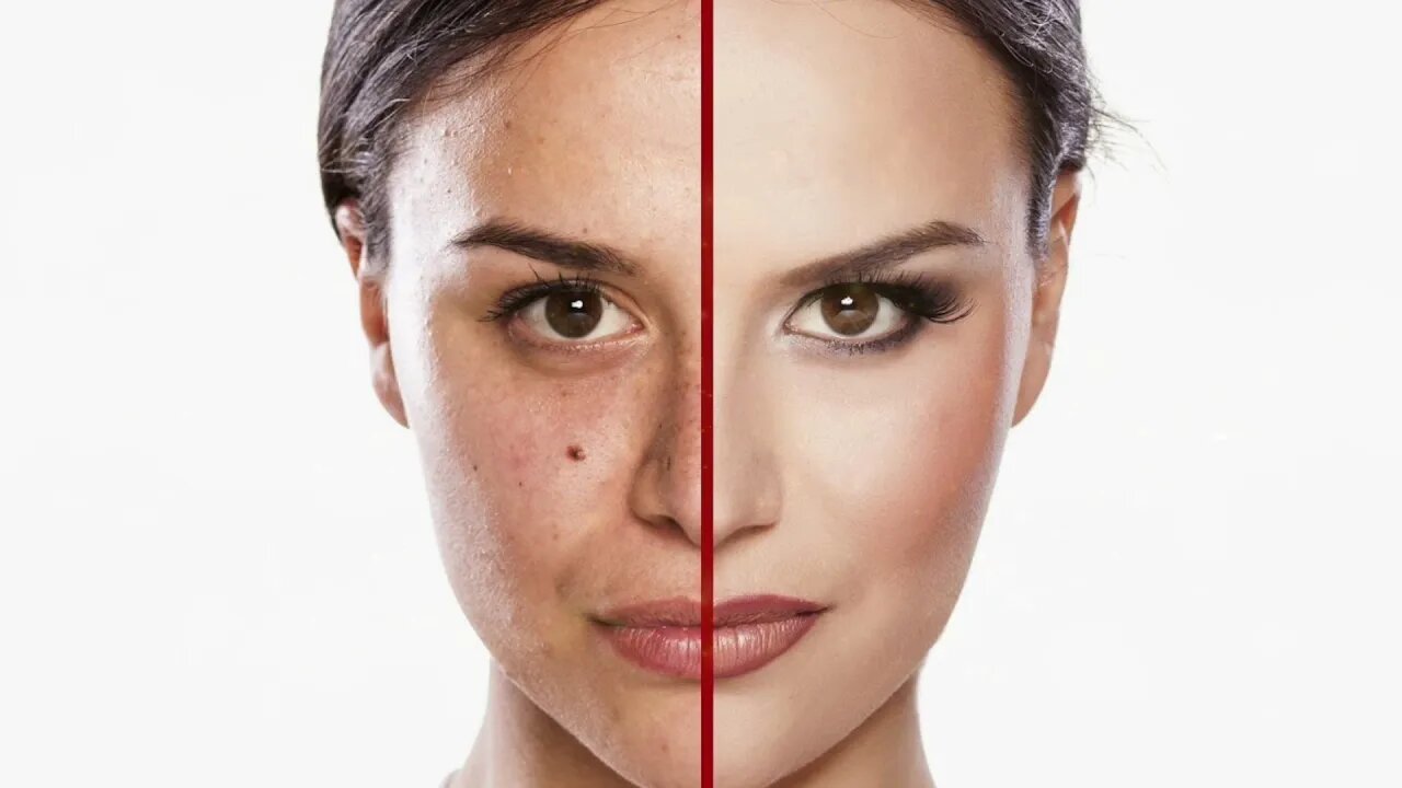 Dark circles? Moles? Blemishes? Take care of all with Subliminals In Less Than 10 Minutes!