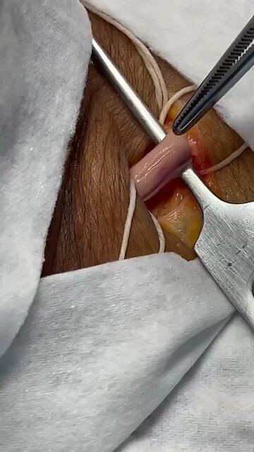 If you got a Pfizer or Moderna mRNA jab (even one)