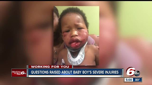 Mother seeks answers after 1-year-old son severely injured at Indy daycare