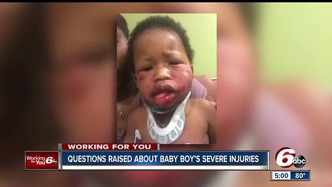 Mother seeks answers after 1-year-old son severely injured at Indy daycare