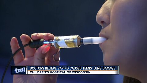 Doctors believe vaping caused teens' lung damage in Wisconsin