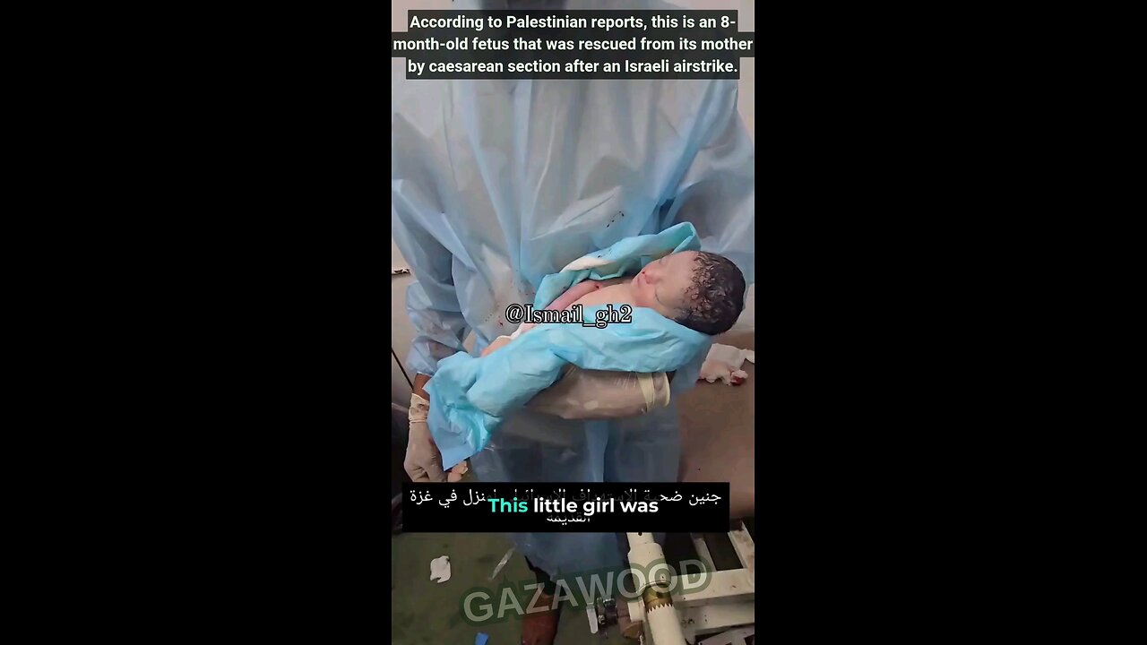 Oh no! Another Silicone Baby dead in Gaza. Watch and read captions to the end...