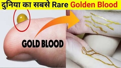 दुनिया का सबसे Rare Golden Blood | World's Rare Golden Blood 🩸#shorts #facts