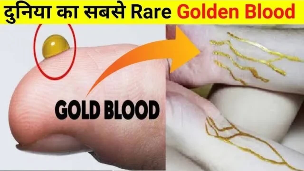 दुनिया का सबसे Rare Golden Blood | World's Rare Golden Blood 🩸#shorts #facts