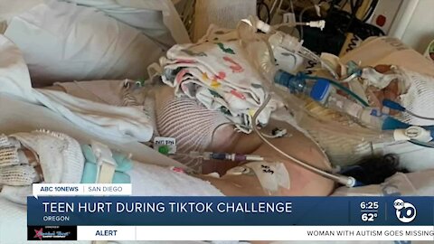 Teen hurt during TikTok fire challenge