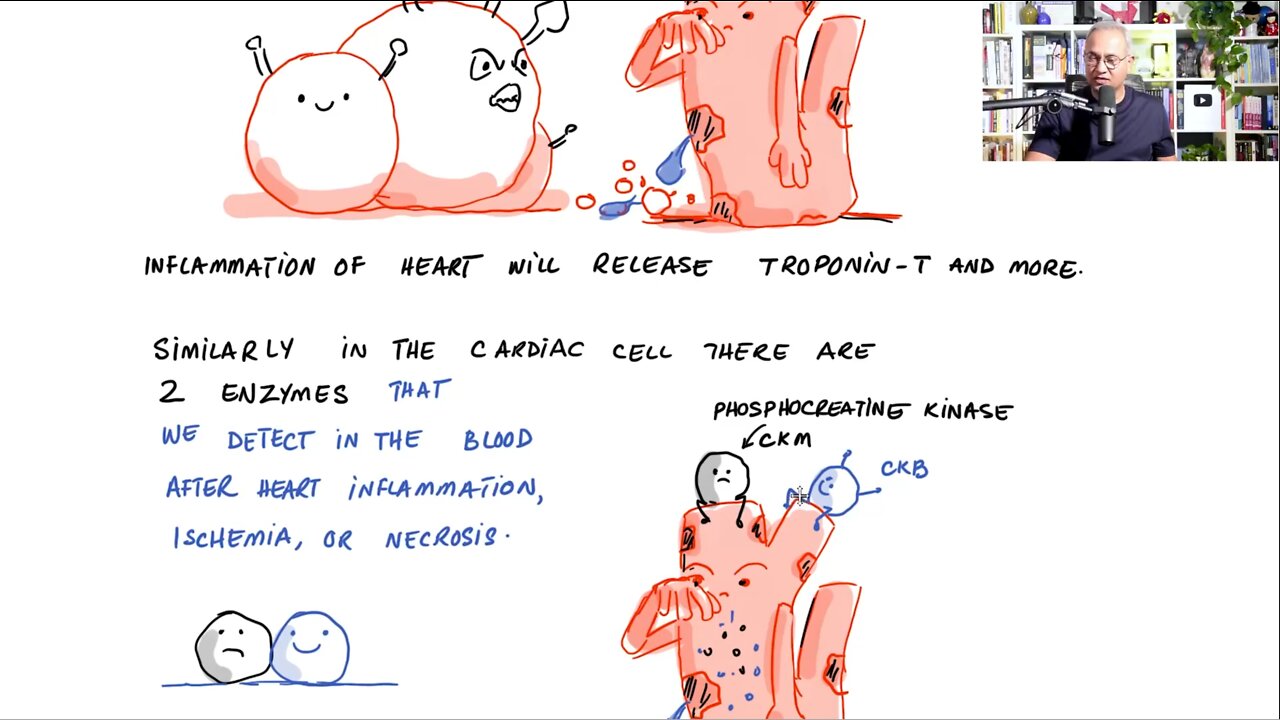 Cardiovascular Effects of mRNA COVID-19 Vaccines in Adolescents (Preprint Thai Study)