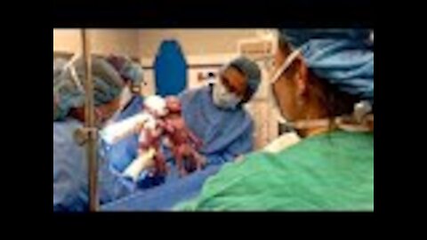 Doctor Gasps Seconds After Delivering Twins, Looking Down We See Why!