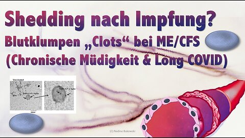 Neuste Studien zu Shedding und Ursachen von Chronischer Müdigkeit & Long-Covid, LymeBorr. und ACA