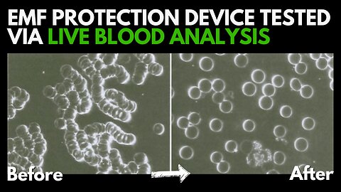 Experience EMF Protection in Action: Live Blood Analysis with Dr. Marlene Siegel & Essential Energy