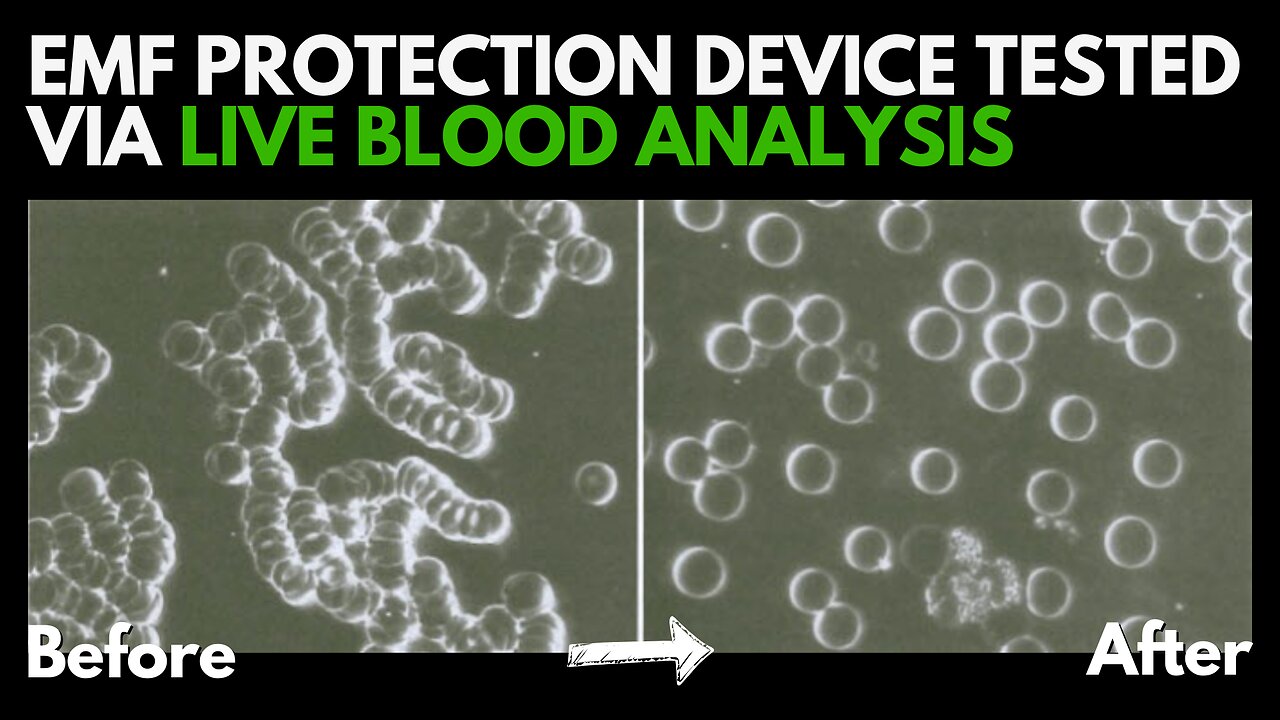 Experience EMF Protection in Action: Live Blood Analysis with Dr. Marlene Siegel & Essential Energy