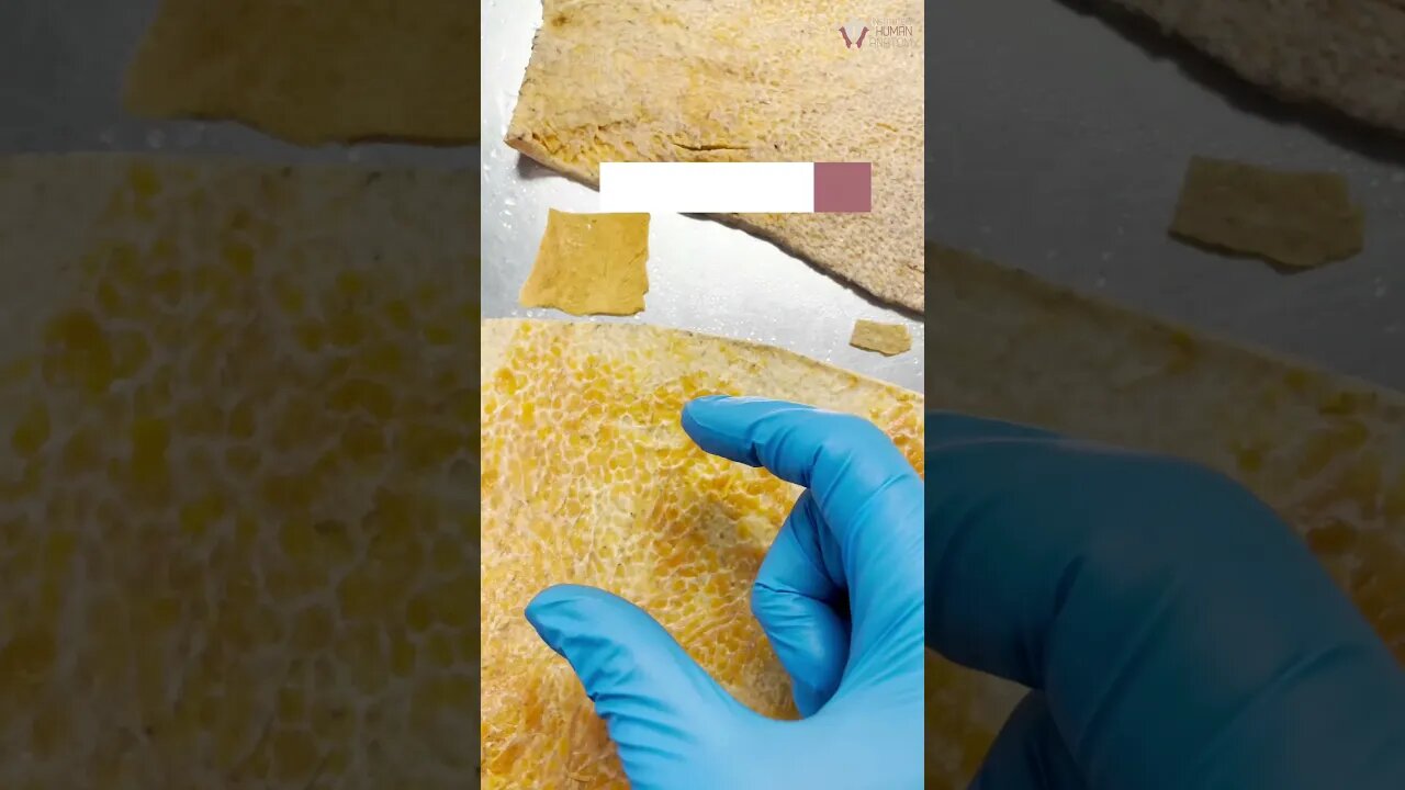 Showing How Thick REAL Human Skin Is