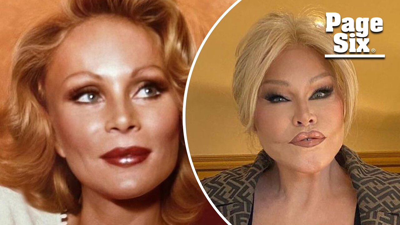 'Catwoman' Jocelyn Wildenstein reveals her original face in shocking throwback photo