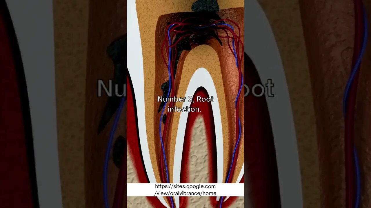 What are the three major dental problems?