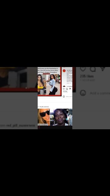 Surgeons Should Stop Working on this Woman Retro Actively Withdrawing Consent for The BBL's