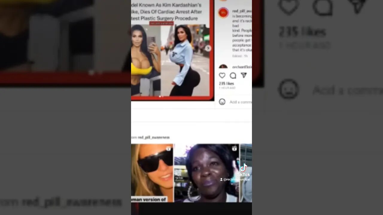 Surgeons Should Stop Working on this Woman Retro Actively Withdrawing Consent for The BBL's