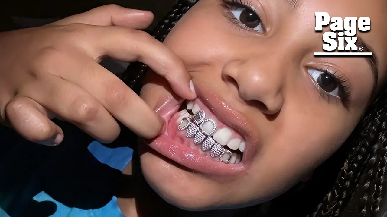 North West, 10, shows off diamond grills as dad Kanye debuts $850K titanium dentures