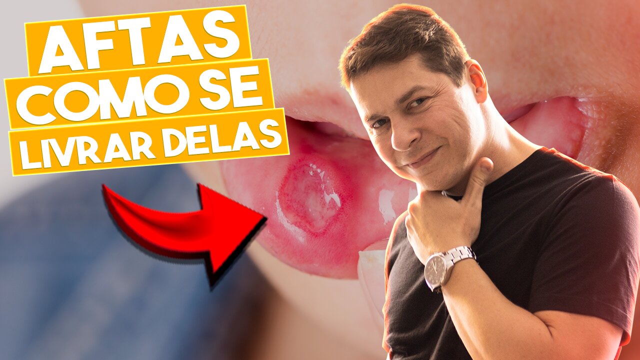 AFTAS - como se LIVRAR das aftas e quais são as CAUSAS / CANKER SORE - HOW TO GET RID OF THEM