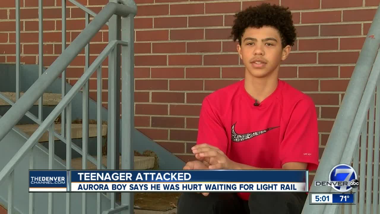 13-year-old boy says man attacked him at Aurora light rail station; police now investigating