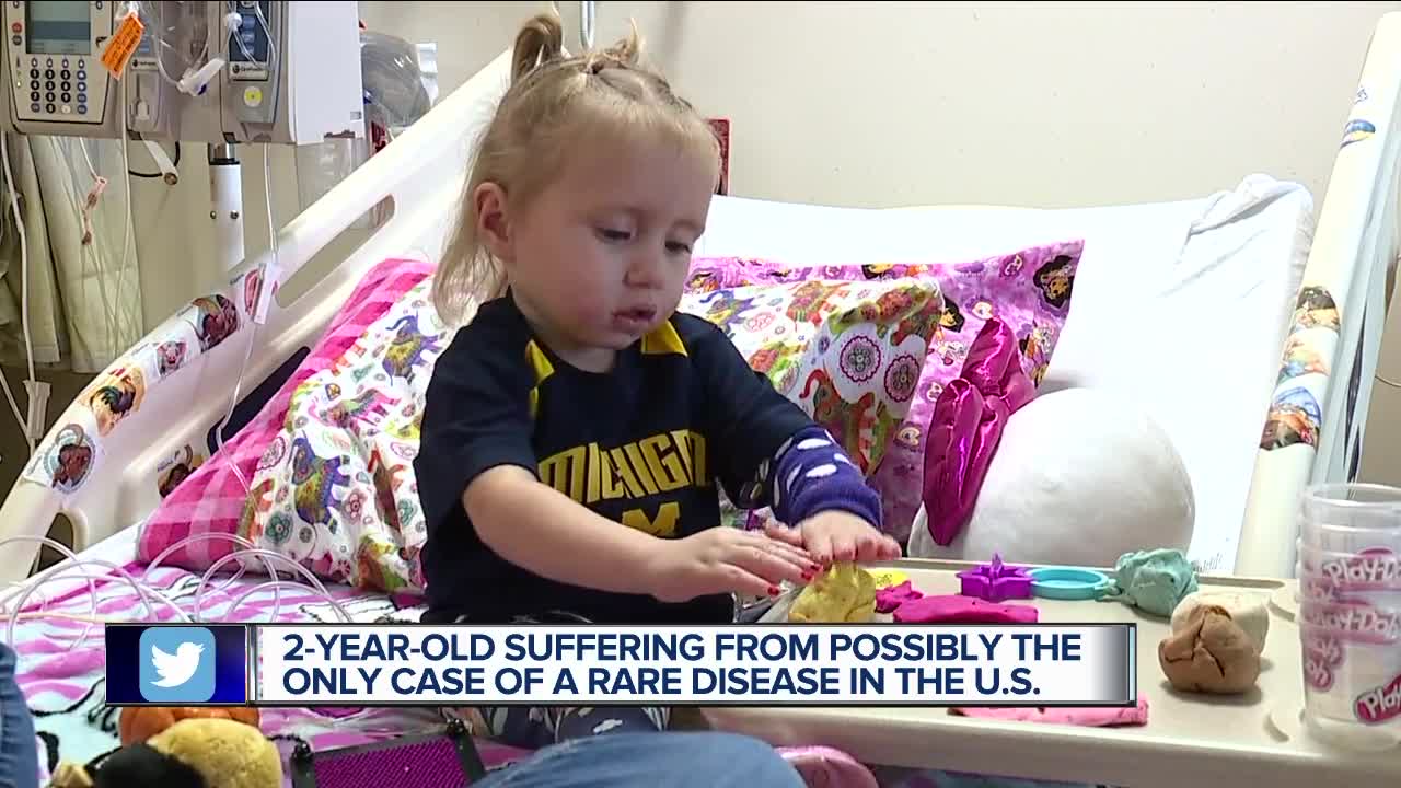 Metro Detroit family fears 2-year-old with very rare disease will never have normal life