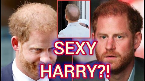 BALD Prince Harry named SEXIEST MAN after his HAIR LOSS gets Attention
